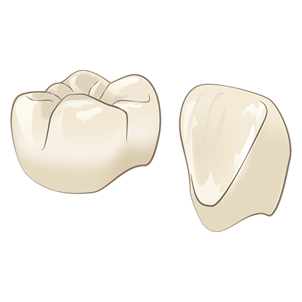 ジルコニアセラミック
