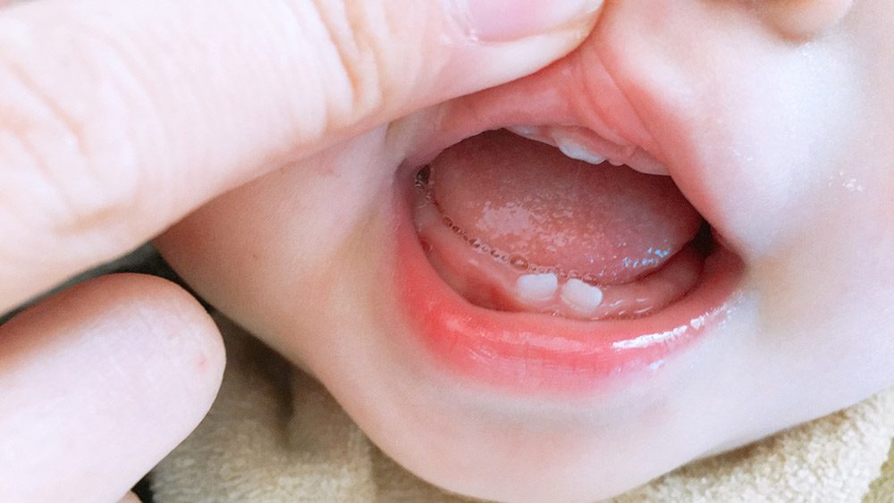 お子さんの歯を一緒に支える