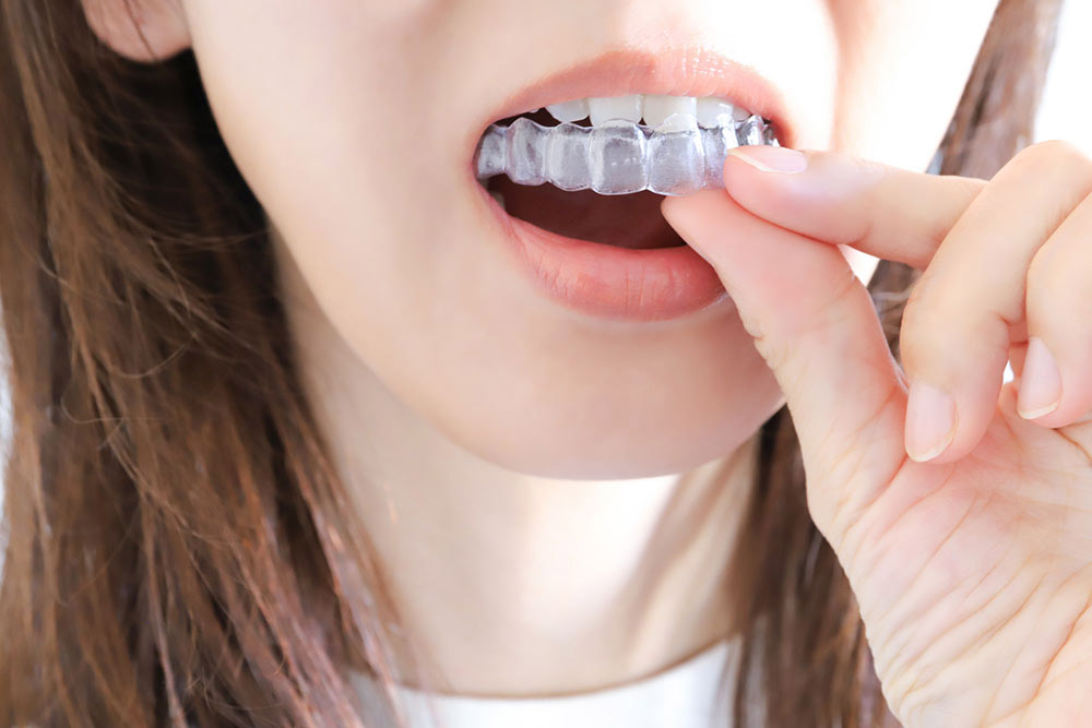 ホワイトニングとは